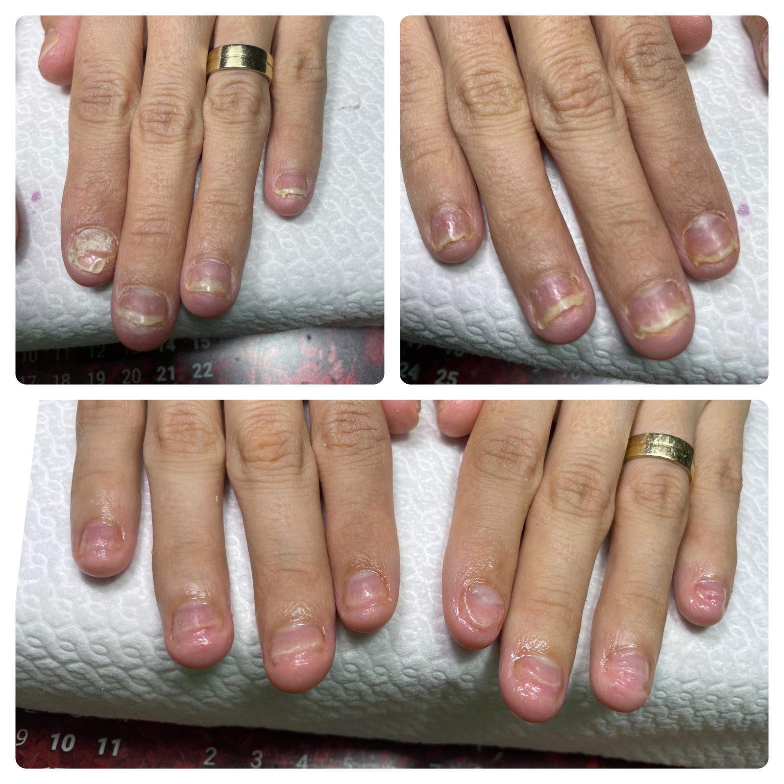Before and after - rezultat 2